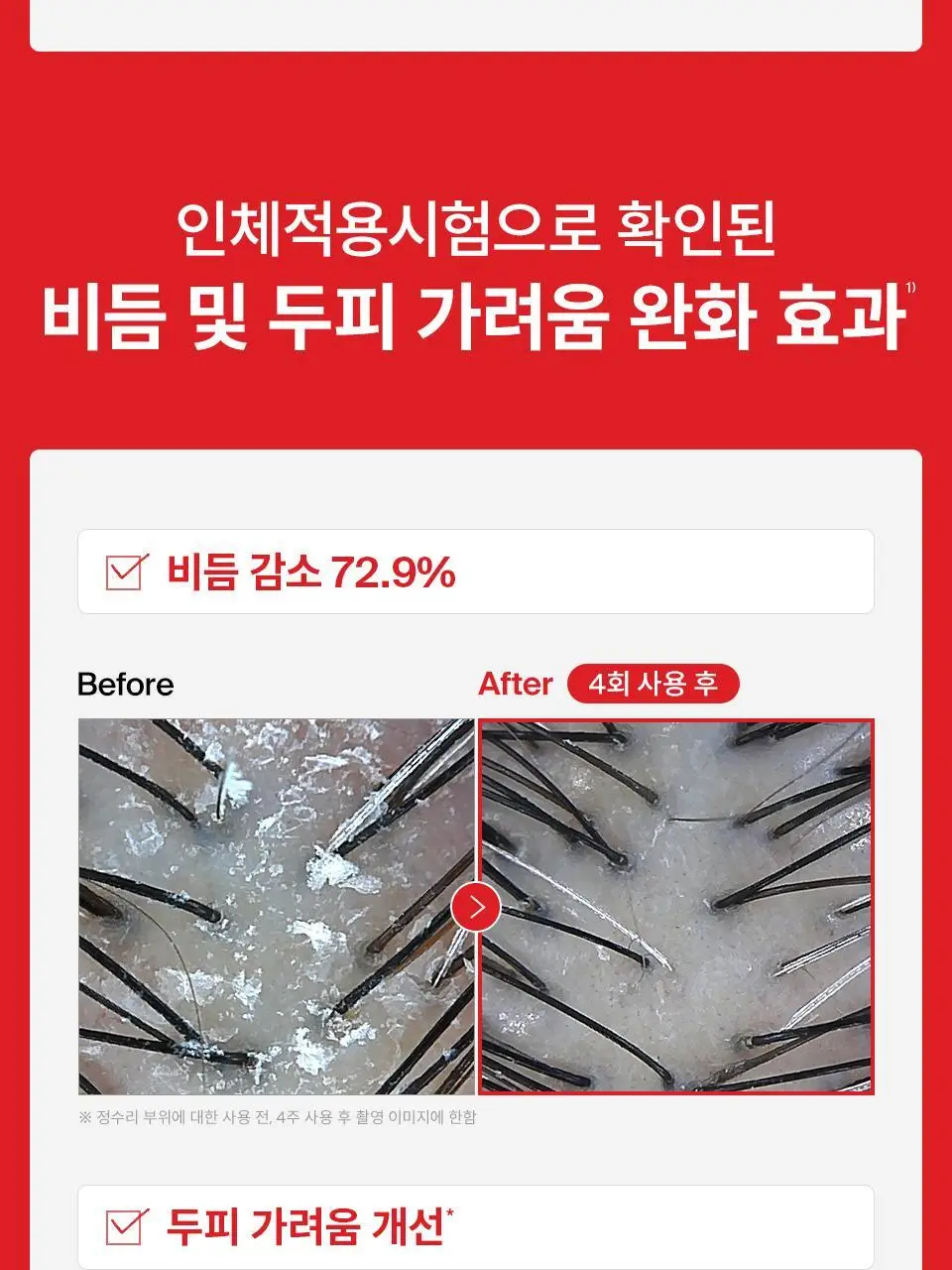 [단독기획] 닥터포헤어 폴리젠 씨크닝 샴푸 400ML기획 (+100ml) 탈모 볼륨 샴푸 상세페이지 32